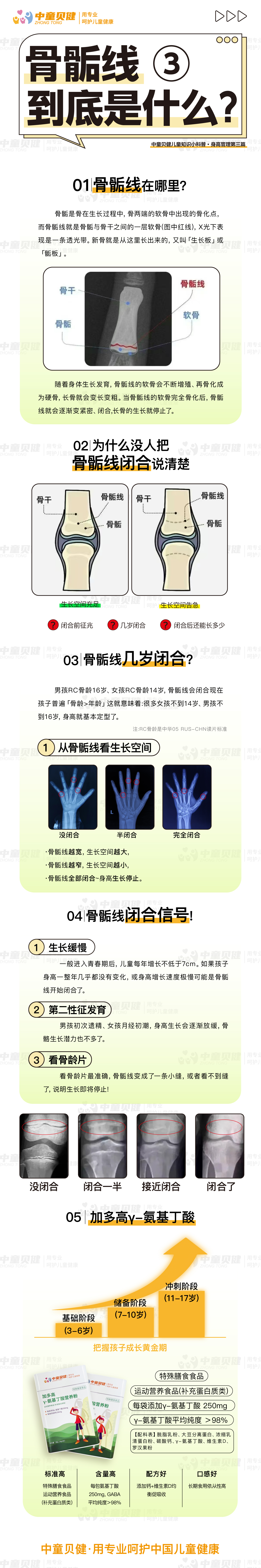 中童-骨骺线.jpg